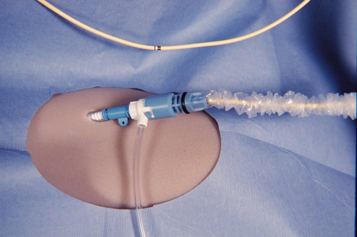 Pulmonary Artery Catheter Placement Simulation